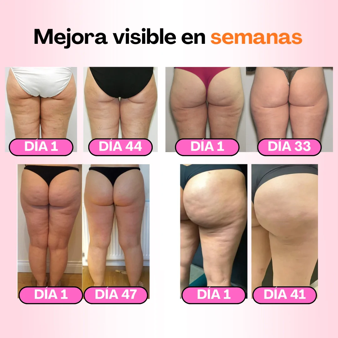 Mallas Anticelulíticas - Redefine tu silueta sin esfuerzo (Pack de 3) - Image 3