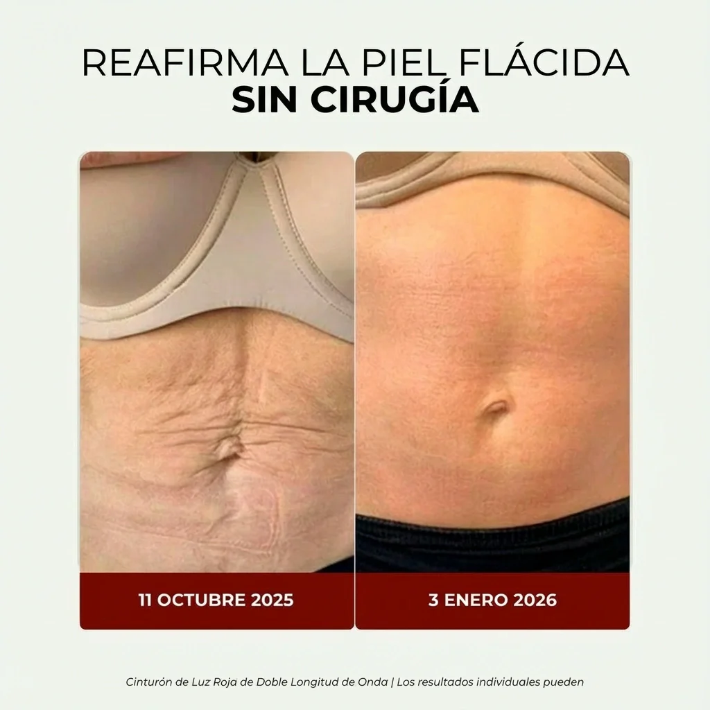 Faja de Luz Roja para Reafirmar el Abdomen y Recuperar la Confianza - Image 4