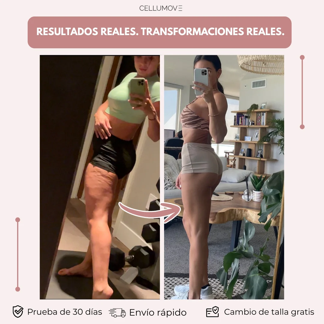 Las mallas anticelulíticas para mujeres que lo han probado todo: resultados visibles en 14 días - Image 3