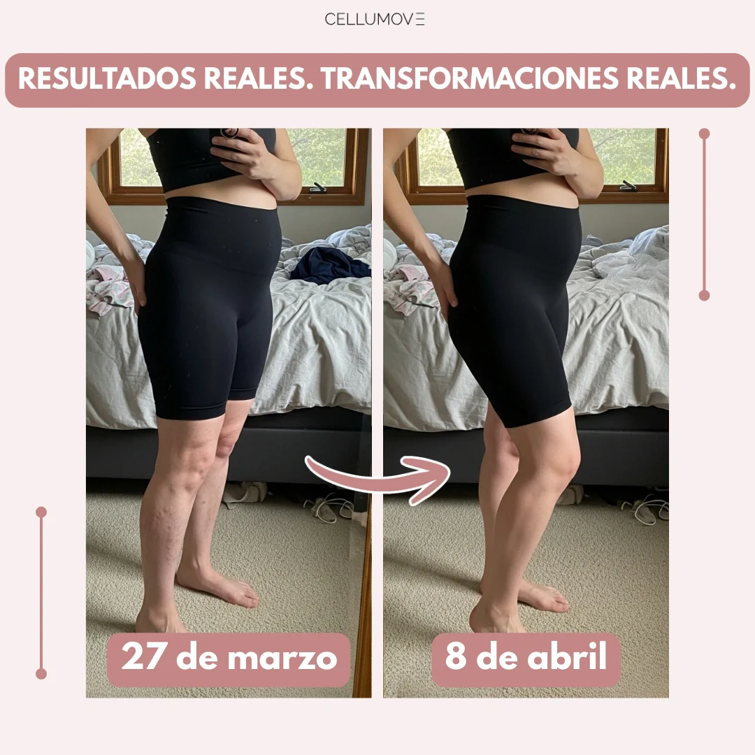 Leggings Cellumove 3D – Edema posparto - Image 3