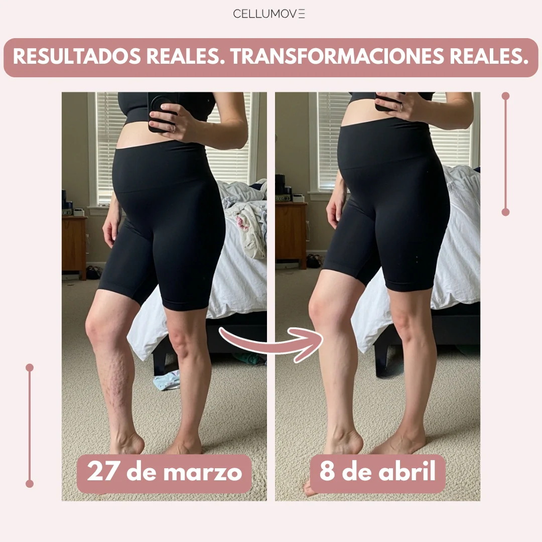 Leggings Cellumove 3D – Edema posparto - Image 4