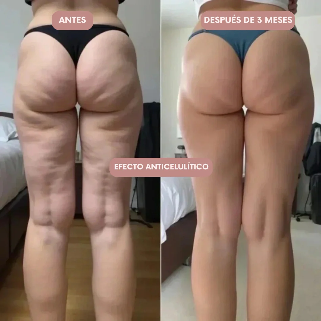 Legging 3D Cellumove – Redefine tu silueta sin esfuerzo - Image 5