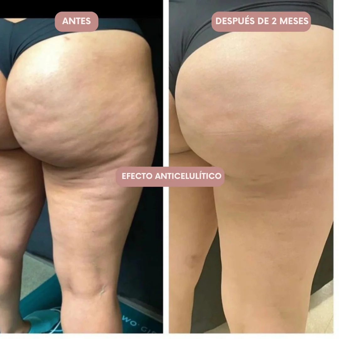 Legging 3D Cellumove – Redefine tu silueta sin esfuerzo - Image 6