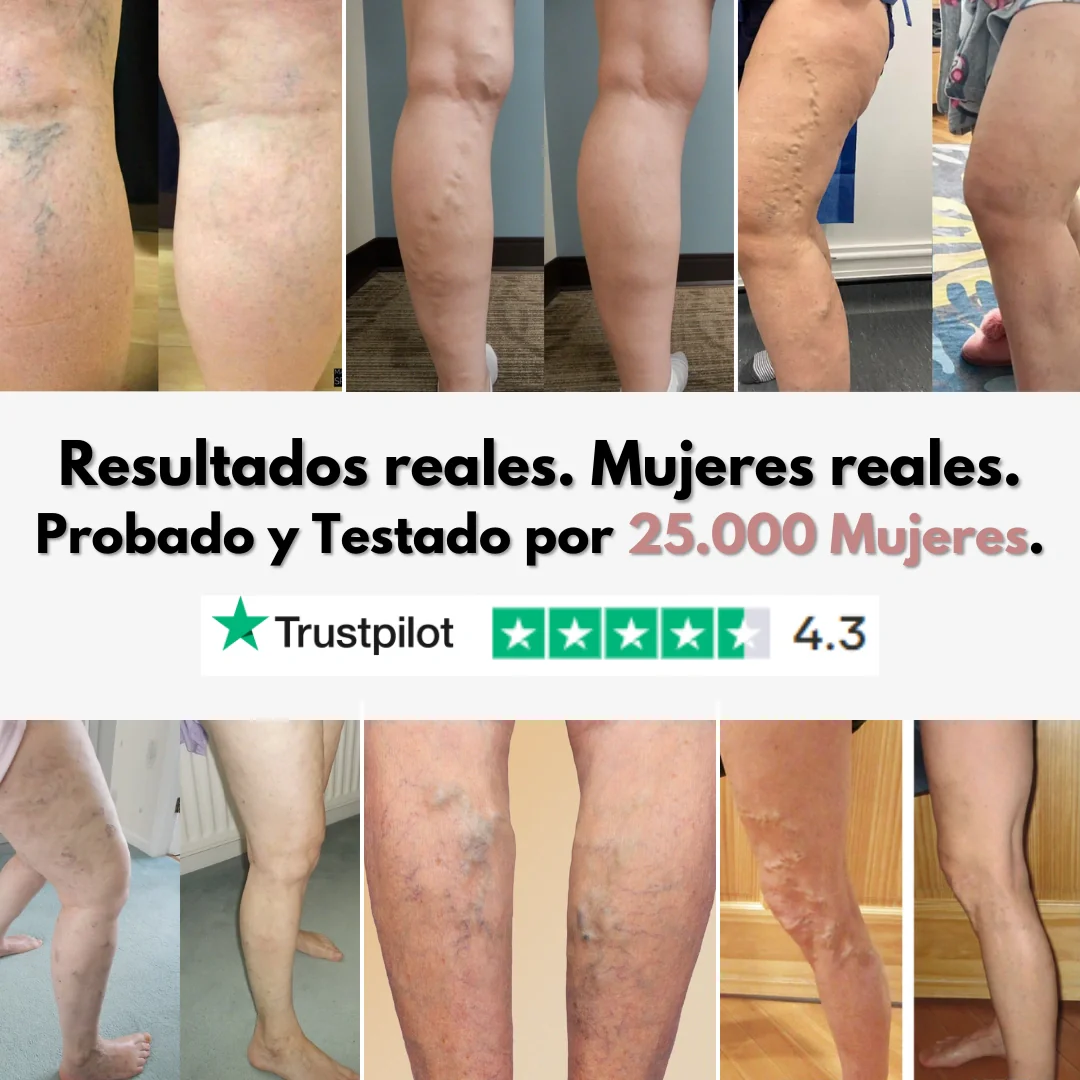 Cellumove 3D Legging: alivia y previene las varices de forma natural. - Image 5