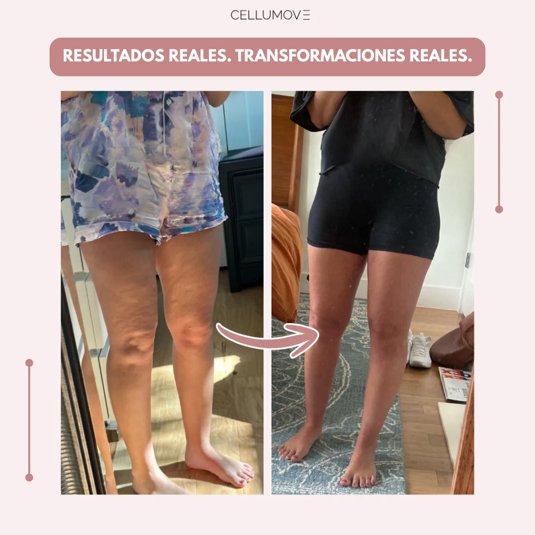 Cellumove 3D Legging – Despídete del dolor y la fatiga del lipoedema de forma natural - Image 6