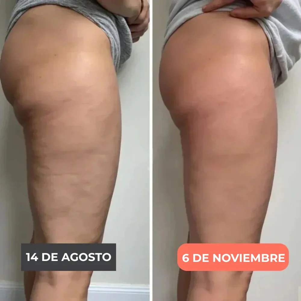 Legging 3D Cellumove – Redefine tu silueta sin esfuerzo - Image 5