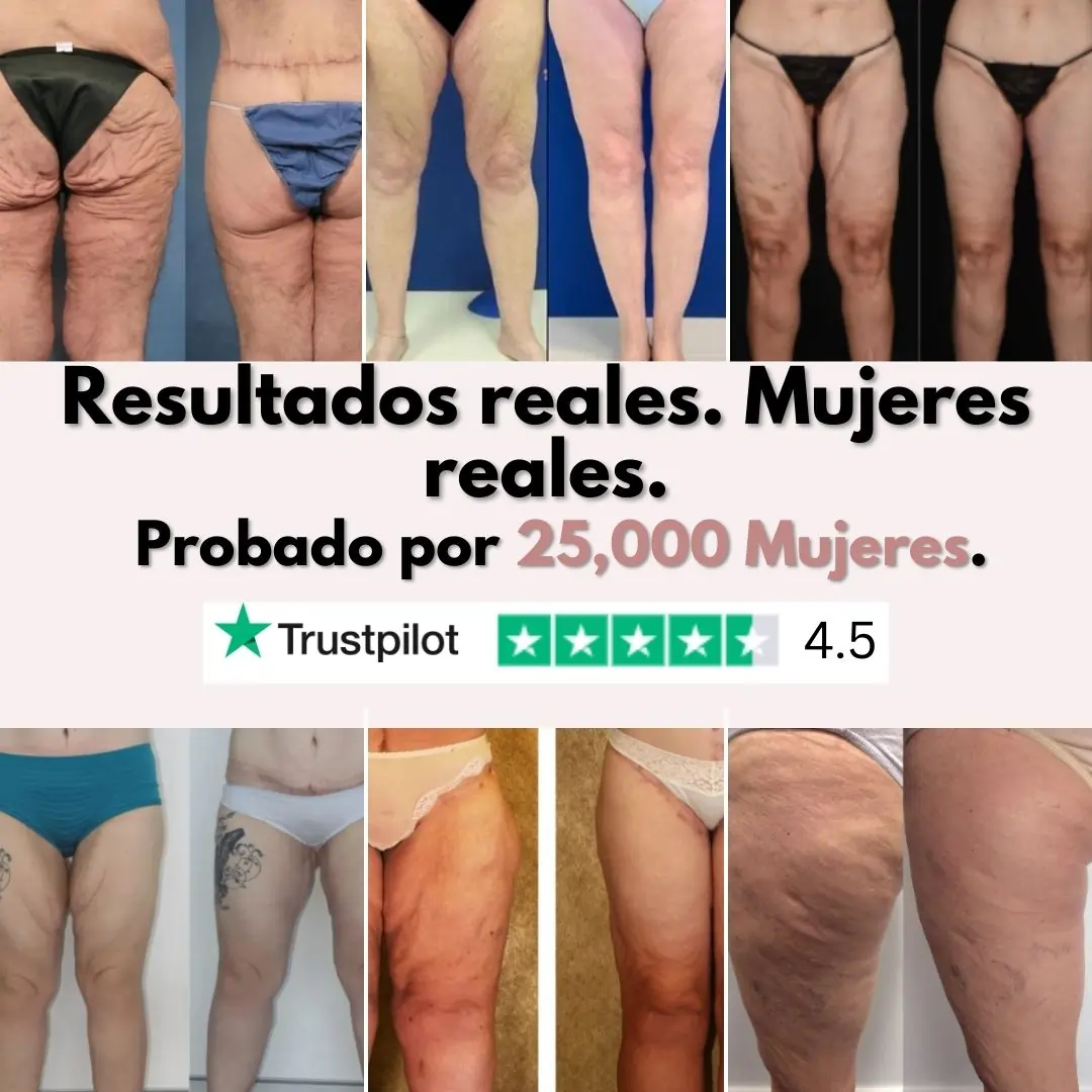 Piernas más firmes y suaves en 14 días — para mujeres cansadas de que la piel flácida las detenga (modelo mayor) - Image 6